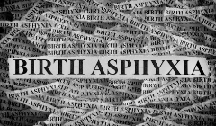 Birth asphyxia