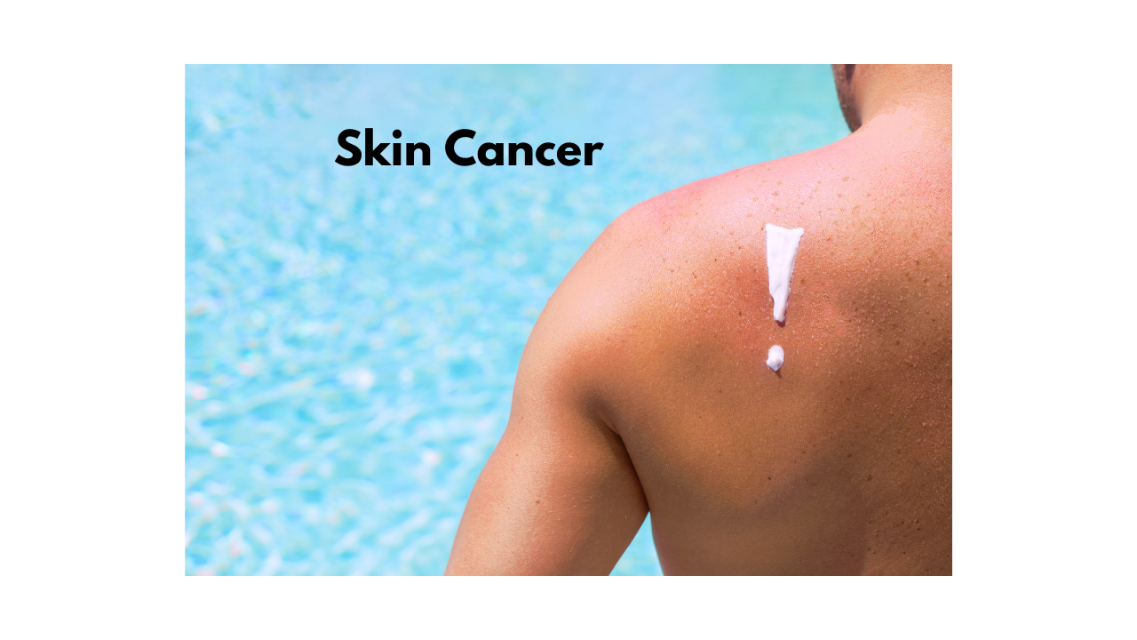 What are the Symptoms of Skin Cancer?