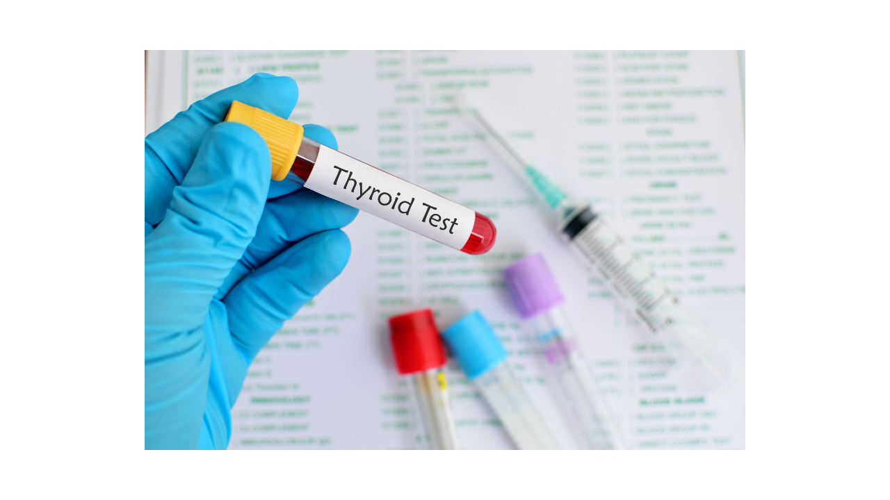What are thyroid function tests?