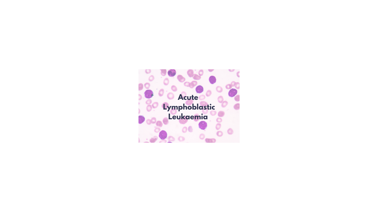 What is Acute lymphoblastic leukaemia: Children?