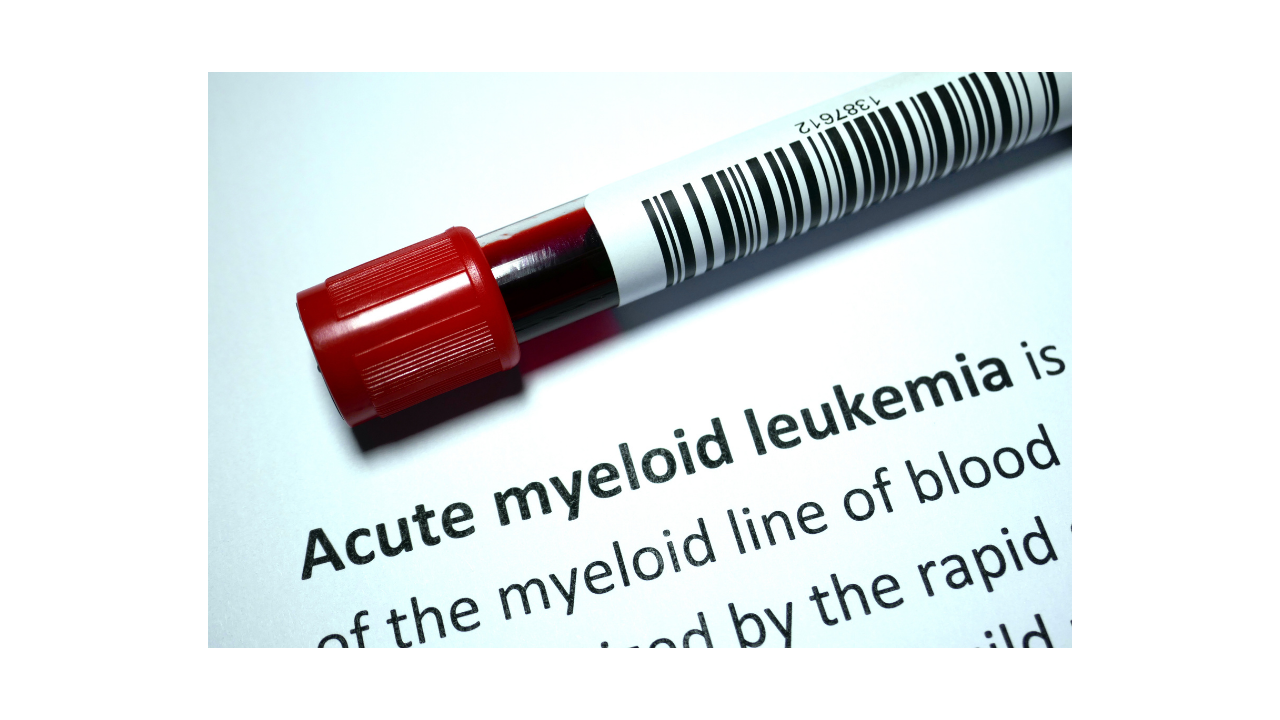 What is Acute myeloid leukemia (AML)