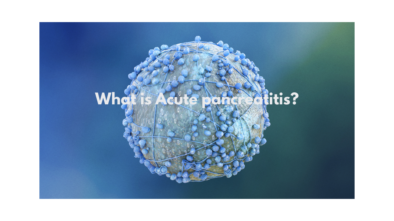 What is Acute pancreatitis