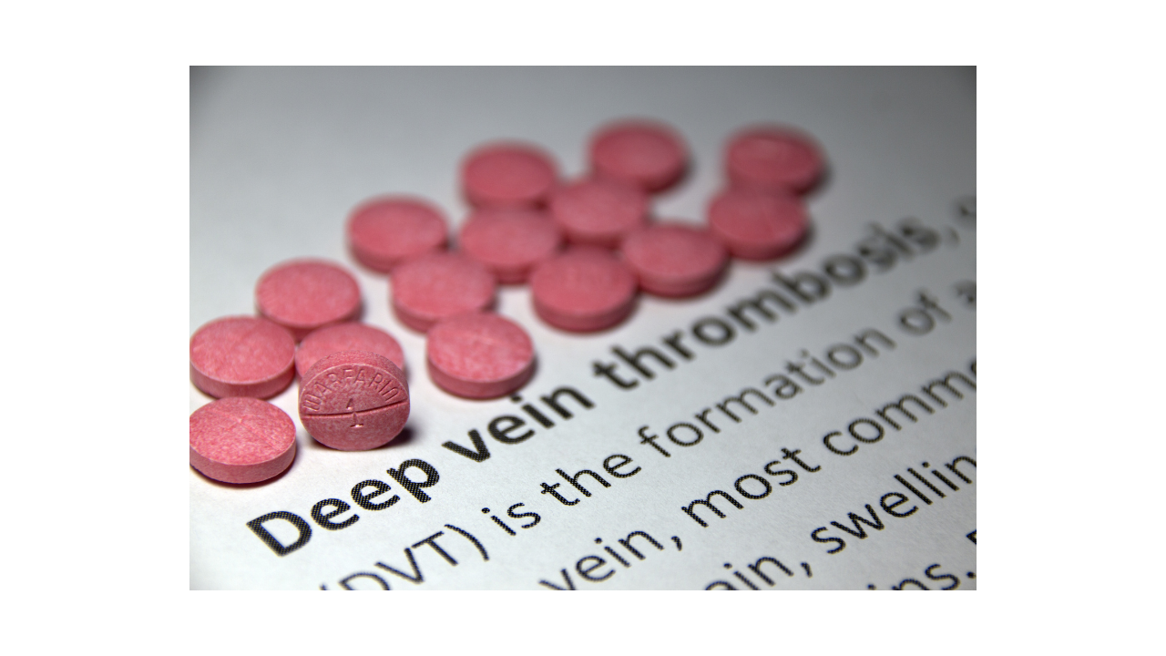 What is Deep vein thrombosis (DVT)