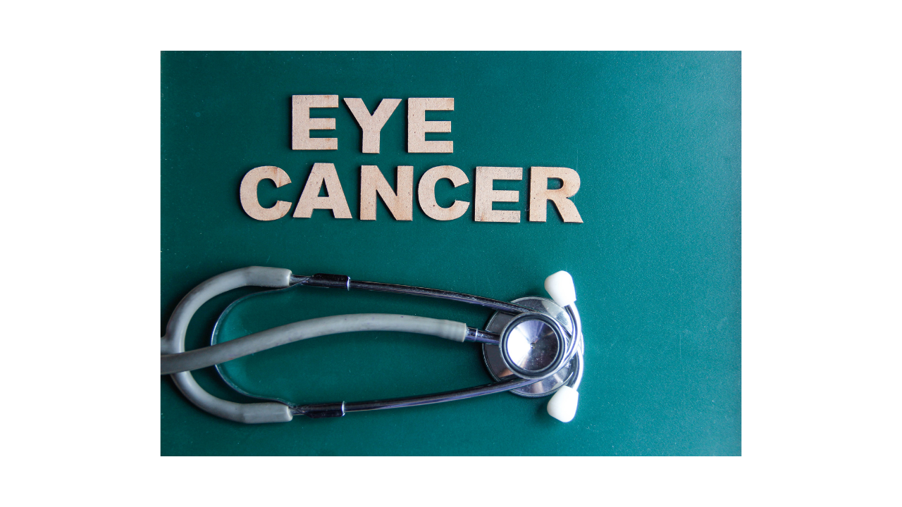 What is Eye cancer
