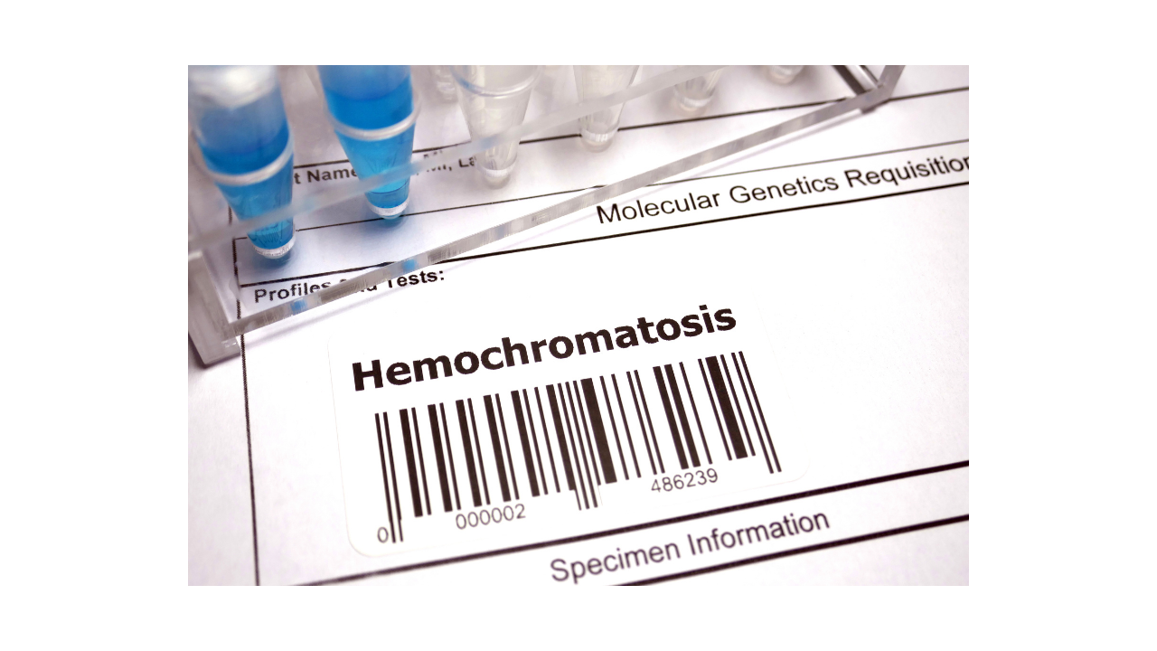 What is Hemochromatosis