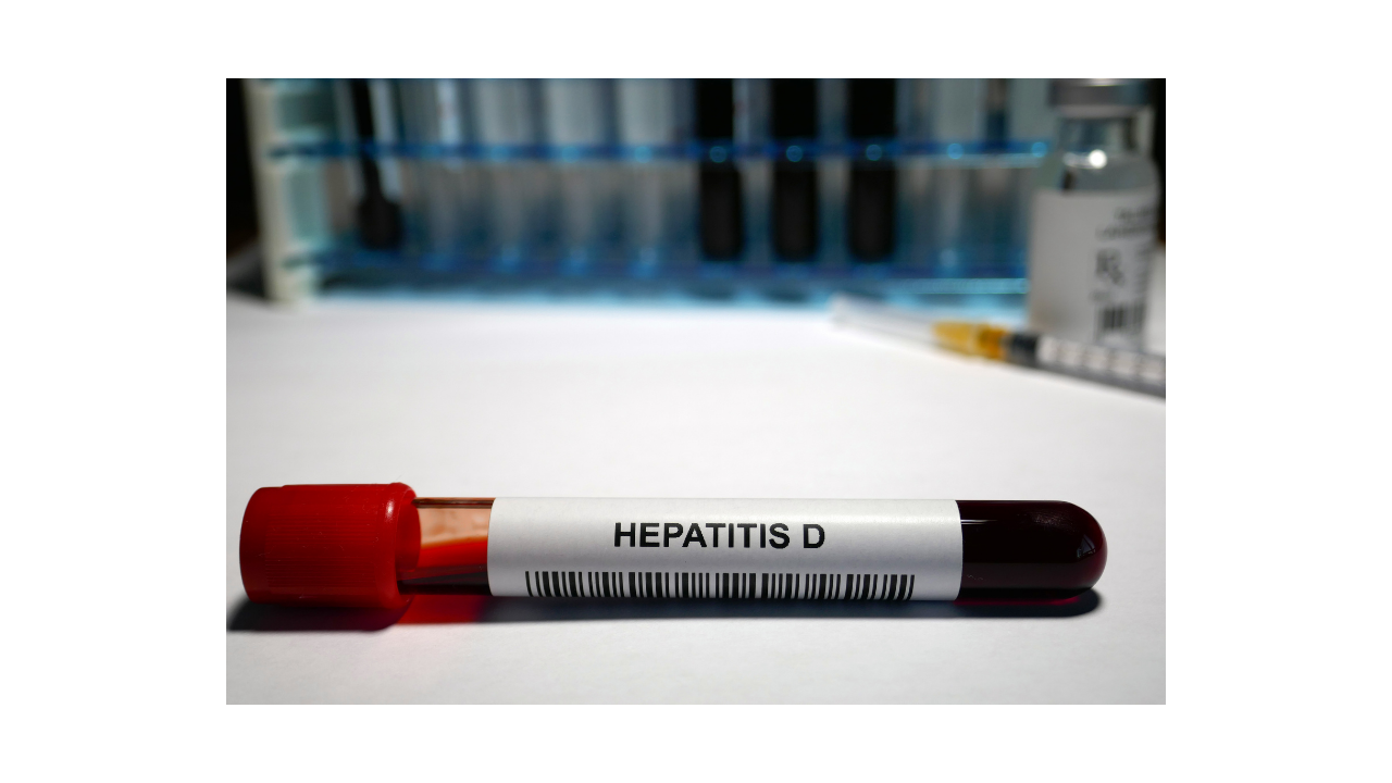 What is Hepatitis D ?