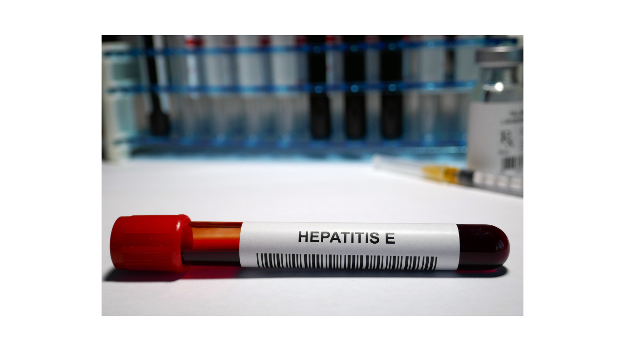 What is Hepatitis E ?