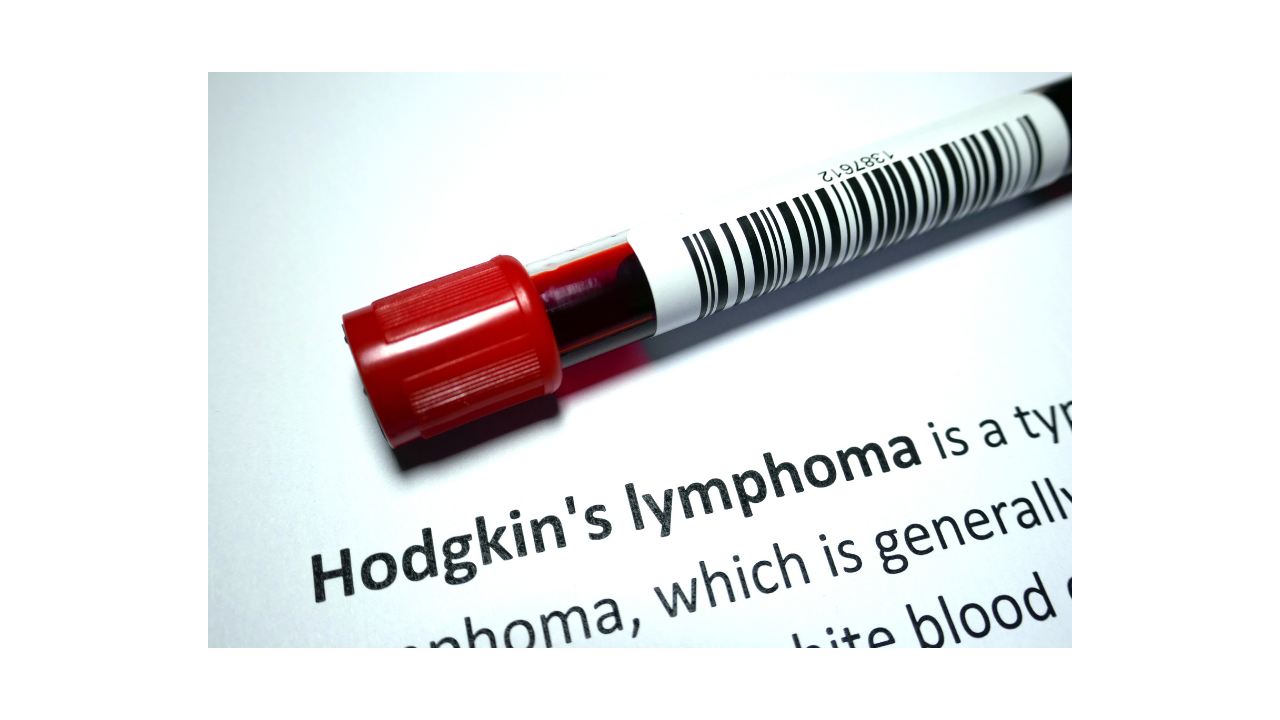 What is Hodgkin's lymphoma