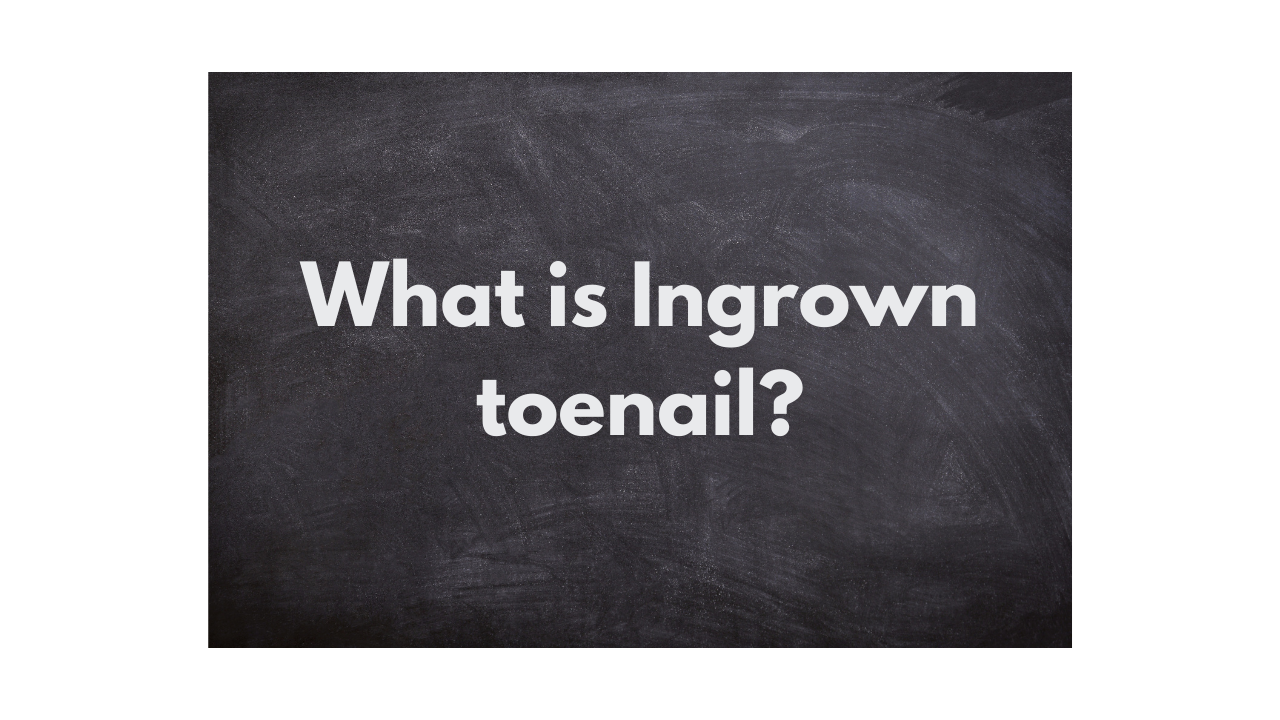 What is Ingrown toenail