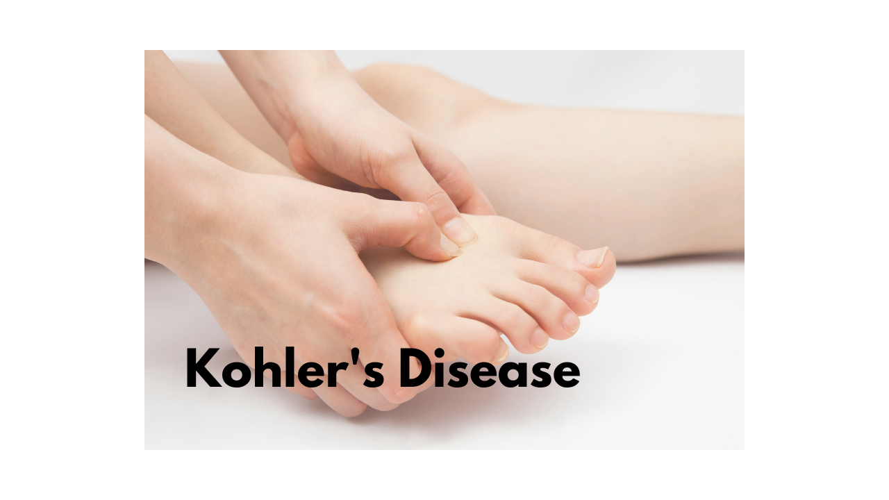 What is Kohler's Disease ?