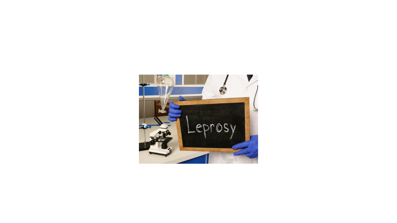 What is Leprosy?
