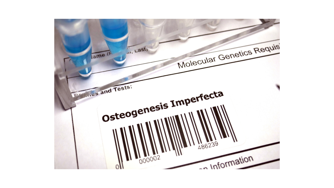 What is Osteogenesis imperfecta (OI)?