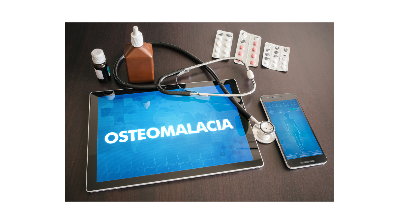 What is Osteomalacia?