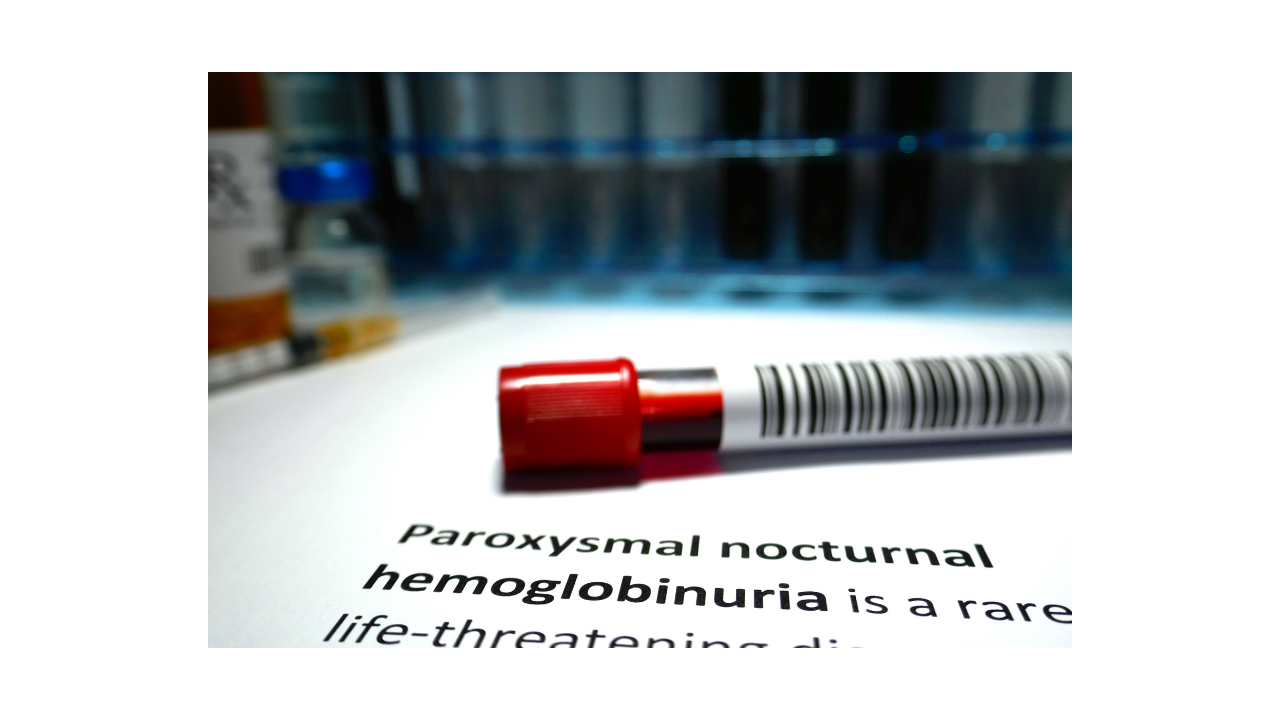 What is Paroxysmal nocturnal hemoglobinuria (PNH)?