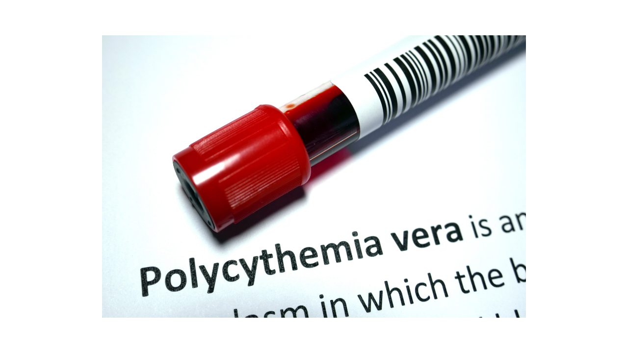 What is Polycythemia vera