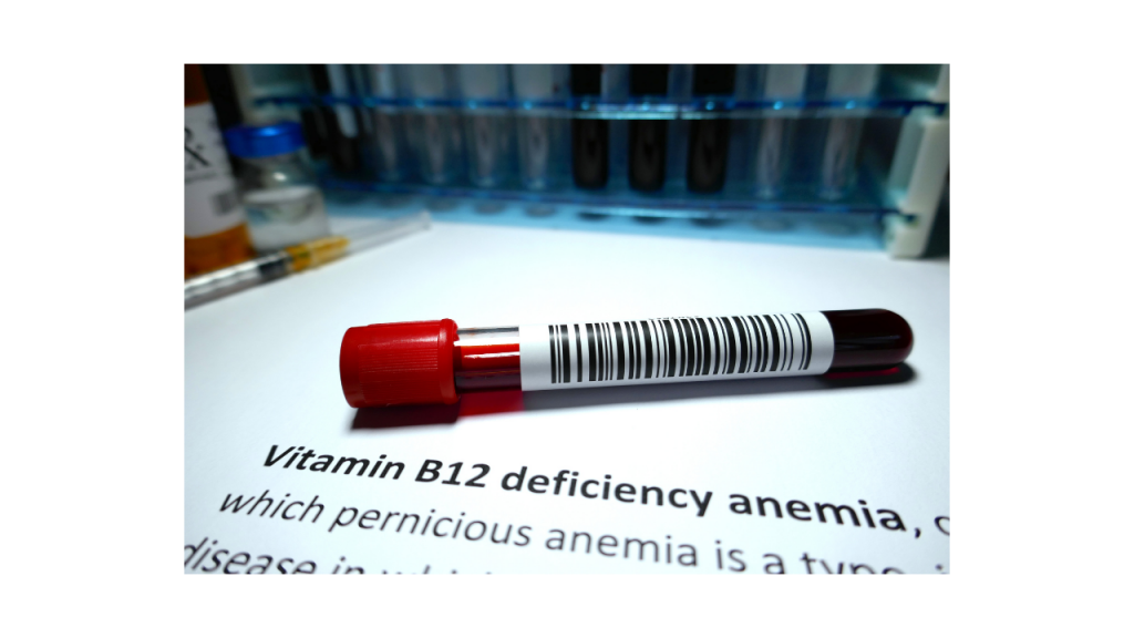 What Is Vitamin B12 Deficiency Anemia?