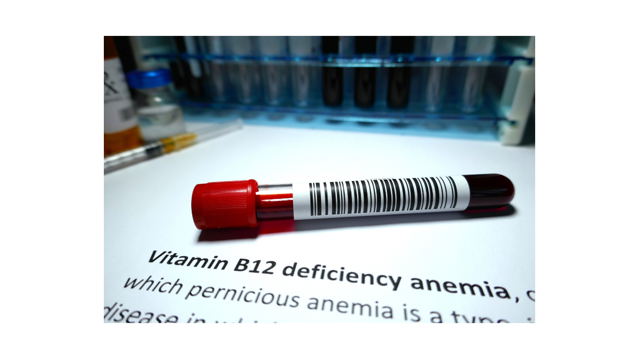 What is Vitamin B12 deficiency anemia