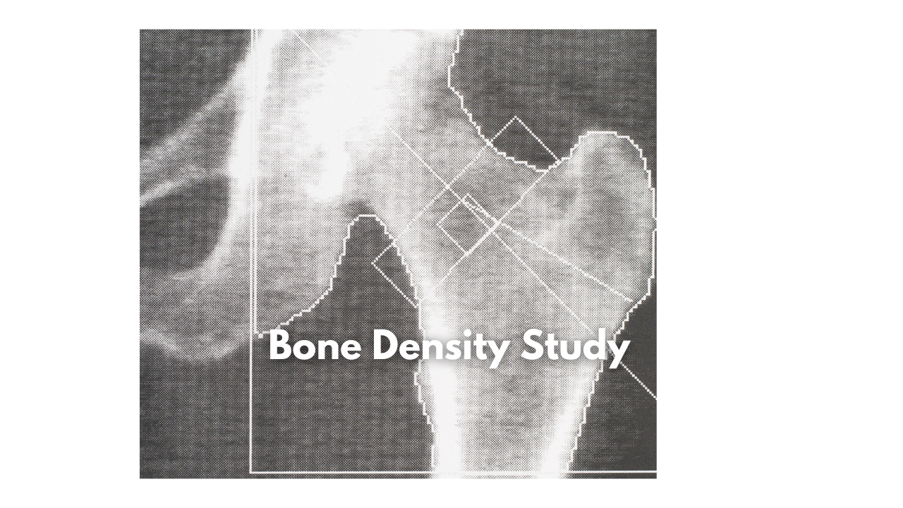 What is a Bone Density Study?