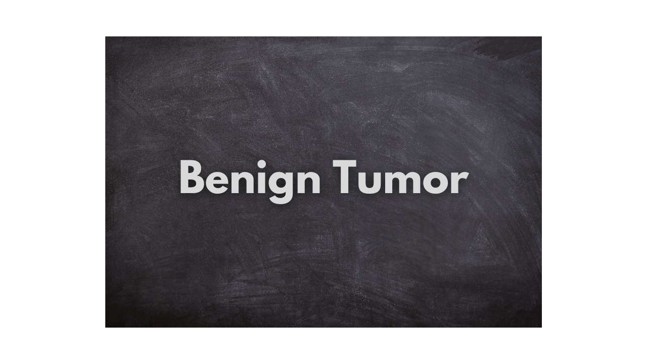 What is a benign tumor?