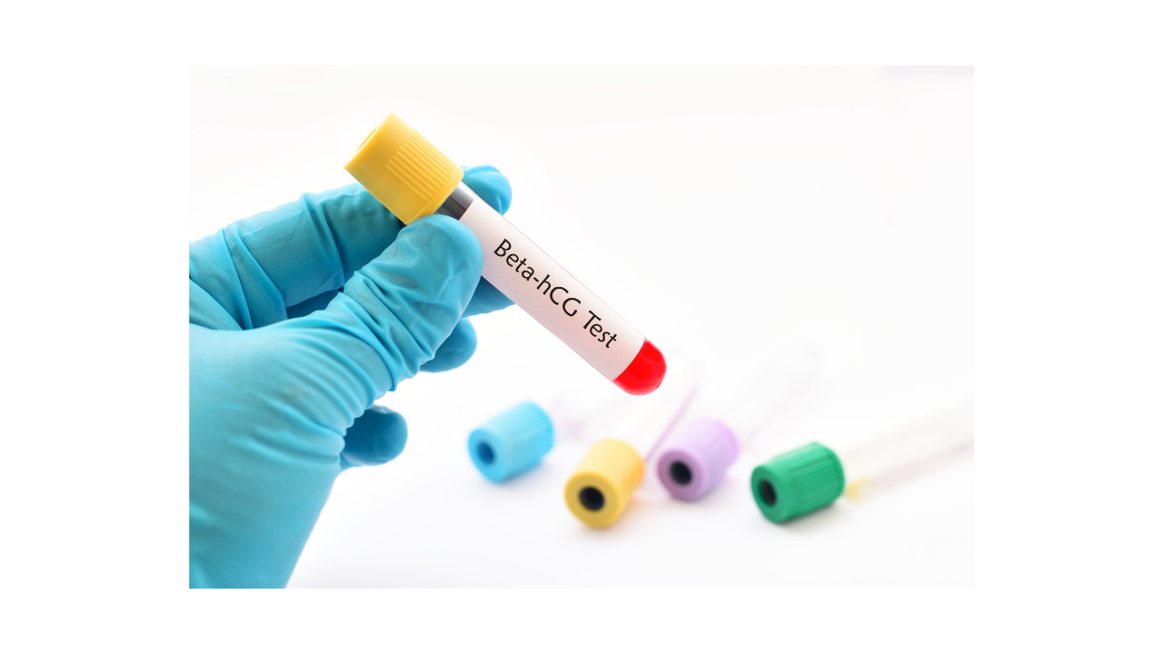 What is an hCG test?