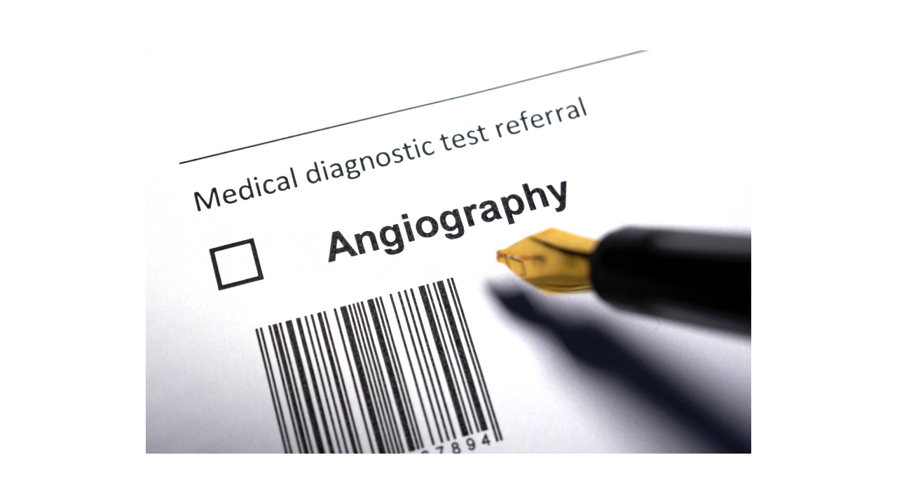 What is angiography?