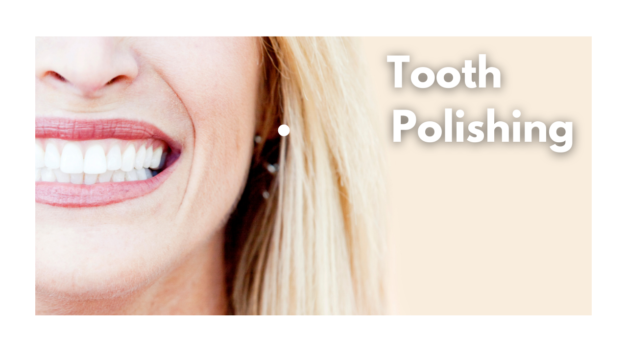 What is tooth polishing?