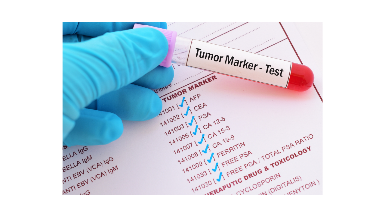 What is tumor marker test?