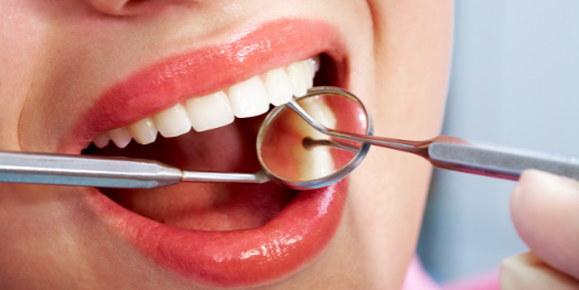 Five benefits of maintaining good oral health